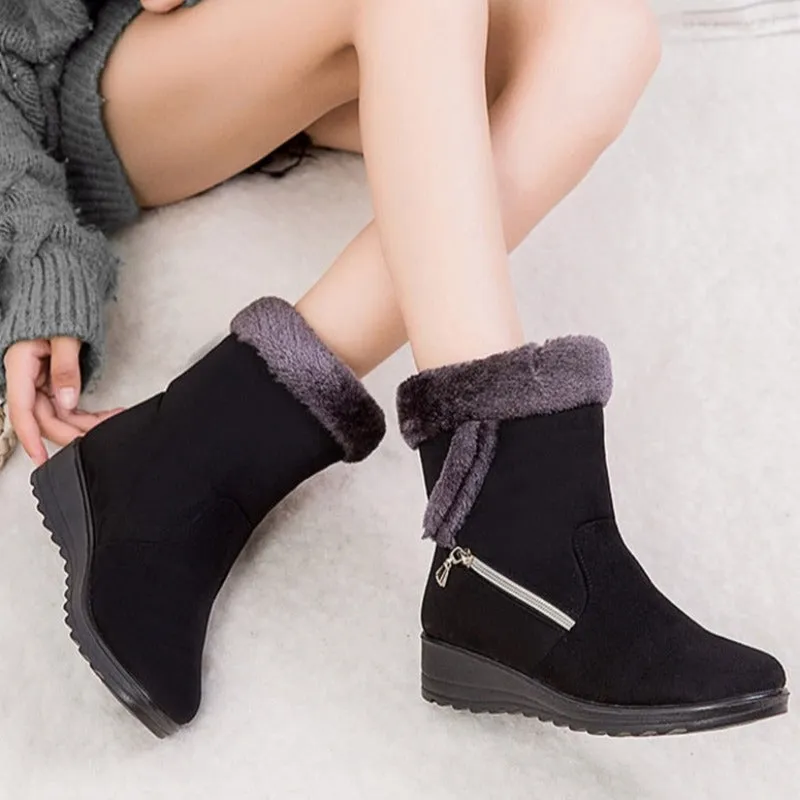 Dyavor Women Winter Boots Fur Collar Casual Orthopedic Shoes